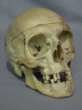 A model of a human skull