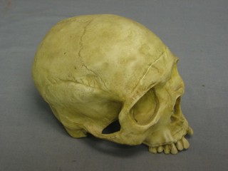 A dental plastic model of a human skull (minus jaw bone)