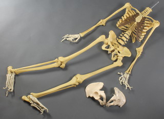 A 20th Century plastic skeleton, missing skull and with 1 detached right finger